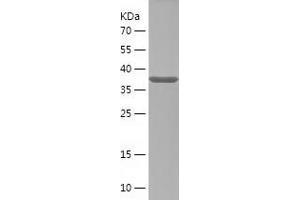 Western Blotting (WB) image for serine/threonine Kinase 32A (STK32A) (AA 258-396) protein (His-IF2DI Tag) (ABIN7283976) (STK32A Protein (AA 258-396) (His-IF2DI Tag))