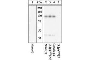 Image no. 1 for anti-Insulin Receptor (INSR) (pTyr972) antibody (ABIN1495716) (Insulin Receptor antibody  (pTyr972))