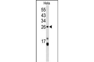 Western blot analysis of CENPH Antibody in Hela cell line lysates (35ug/lane)