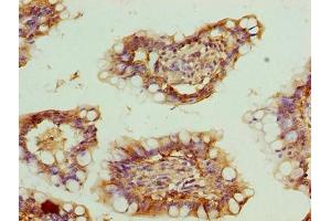 Immunohistochemistry of paraffin-embedded human small intestine tissue using ABIN7176207 at dilution of 1:100 (ZNF281 antibody  (AA 1-300))