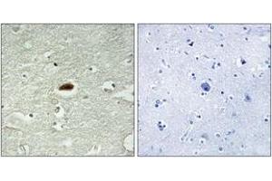 Immunohistochemistry analysis of paraffin-embedded human brain tissue, using Period Circadian Protein 2 (Ab-662) Antibody. (PER2 antibody  (AA 636-685))