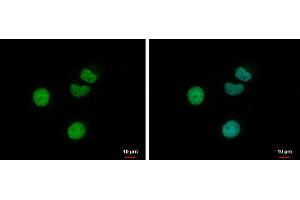 ICC/IF Image Retinoic Acid Receptor gamma antibody detects Retinoic Acid Receptor gamma protein at nucleus by immunofluorescent analysis. (Retinoic Acid Receptor gamma antibody)