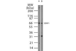 Image no. 1 for anti-SUMO1/sentrin Specific Peptidase 1 (SENP1) (AA 578-590) antibody (ABIN208752) (SENP1 antibody  (AA 578-590))