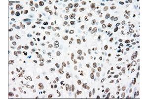Image no. 1 for anti-Polo-Like Kinase 1 (PLK1) antibody (ABIN1500282) (PLK1 antibody)