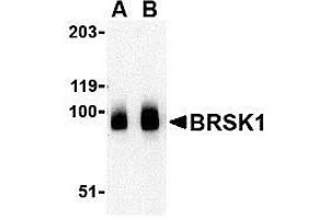 Western blot analysis of BRSK1 in human brain tissue lysate with AP30166PU-N BRSK1 antibody at (A) 0. (BRSK1 antibody  (C-Term))