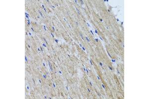 Immunohistochemistry of paraffin-embedded mouse heart using HYAL1 antibody (ABIN5975045) at dilution of 1/100 (40x lens). (HYAL1 antibody)