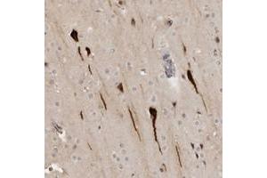 Immunohistochemical staining of human cerebral cortex with RAB11FIP3 polyclonal antibody  shows strong cytoplasmic and nuclear positivity in neuronal cells. (RAB11FIP3 antibody)