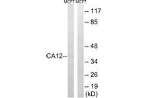 Western blot analysis of extracts from MCF-7 cells, using CA12 Antibody. (CA12 antibody  (AA 231-280))