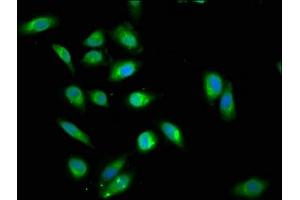 Immunofluorescence staining of Hela cells cells with ABIN7144990 at 1:200, counter-stained with DAPI. (DDX42 antibody  (AA 519-819))