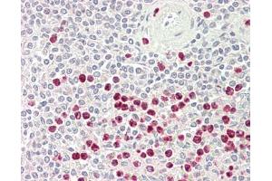 Human Spleen: Formalin-Fixed, Paraffin-Embedded (FFPE). (CCL24 antibody  (HRP))