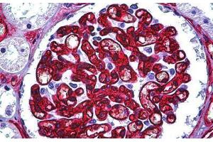 Human Kidney, Glomerulus: Formalin-Fixed, Paraffin-Embedded (FFPE) (CD34 antibody)