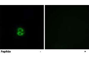 Immunofluorescence analysis of A-549 cells, using CHST6 polyclonal antibody .