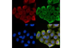 ABIN6262627 and ABIN6268688 staining Hela cells(30 min of UV treatment) by IF/ICC. (IL-4 antibody  (Internal Region))
