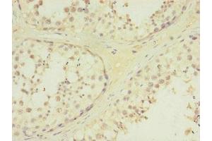 Immunohistochemistry of paraffin-embedded human testis tissue using ABIN7172730 at dilution of 1:100 (MTERFD3 antibody  (AA 1-250))