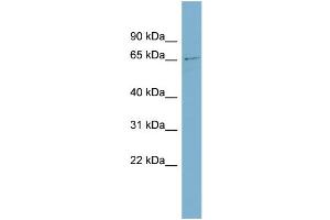 WB Suggested Anti-ZNF18 Antibody Titration:  0.