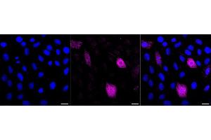 anti-phospholipase C, beta 3 (Phosphatidylinositol-Specific) (PLCB3) (pSer537) antibody