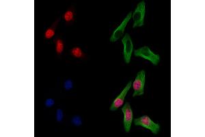 ABIN7094711 and ABIN7098762 staining Hela cells by IF/ICC.