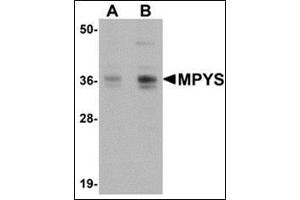 Western blot analysis of MPYS in A-20 cell lysate with AP30565PU-N MPYS antibody at 1 µg/ml (A) and 2 μg/ml (B). (STING/TMEM173 antibody  (C-Term))
