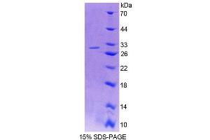 SDS-PAGE (SDS) image for phospholipase C, delta 1 (PLCD1) (AA 1-208) protein (His tag) (ABIN6239511)