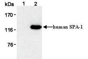 Western Blotting (WB) image for anti-Signal-Induced Proliferation-Associated 1 (SIPA1) antibody (ABIN1449259) (SIPA1 antibody)