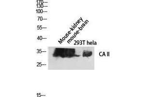 Western Blot (WB) analysis of Mouse Kidney Mouse Brain 293T HeLa lysis using CA II antibody. (CA2 antibody  (C-Term))