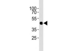 Western blot analysis of lysate from 12 tagged recombinant protein cell lines using HA antibody diluted at 1:1000. (HA-Tag antibody)