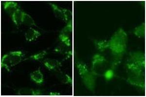 SY5Y cells were pretreated with 5nM bafilomycin for 24hr and fixed in methanol (left panel) or 4% of paraformaldehyde (right panel). (LC3B antibody  (C-Term, cleaved))
