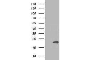 HEK293T cells were transfected with the pCMV6-ENTRY control (Left lane) or pCMV6-ENTRY PMVK (Right lane) cDNA for 48 hrs and lysed. (PMVK antibody)