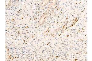 ABIN6267072 at 1/100 staining rat uterine tissue sections by IHC-P.