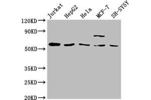 Western Blot Positive WB detected in: Jurkat whole cell lysate, HepG2 whole cell lysate, Hela whole cell lysate, MCF-7 whole cell lysate, SH-SY5Y whole cell lysate All lanes: SLC37A2 antibody at 1:2000 Secondary Goat polyclonal to rabbit IgG at 1/50000 dilution Predicted band size: 55, 43, 14 kDa Observed band size: 55 kDa (SLC37A2 antibody  (AA 46-84))