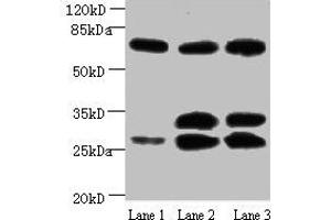 Western blot All lanes: Amyloid beta A4 antibody at 1 μg/mL Lane 1: Mouse heart tissue Lane 2: Mouse kidney tissue Lane 3: Mouse lung tissue Secondary Goat polyclonal to Mouse IgG at 1/15000 dilution Predicted band size: 30, 35, 72, 80 kDa Observed band size: 30, 35, 72 kDa (APP antibody)