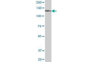 PLB1 MaxPab polyclonal antibody. (Phospholipase B antibody  (AA 1-488))