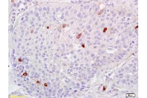 Immunohistochemistry (IHC) image for anti-ADAM Metallopeptidase with Thrombospondin Type 1 Motif, 1 (ADAMTS1) (AA 851-967) antibody (ABIN673404)