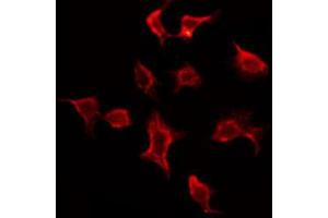 ABIN6273842 staining Hela by IF/ICC. (CMKLR1 antibody  (Internal Region))