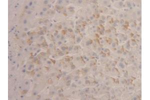 DAB staining on IHC-P; Samples: Human Liver Tissue (IFNA4 antibody  (AA 10-163))