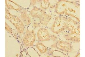 Immunohistochemistry of paraffin-embedded human kidney tissue using ABIN7148068 at dilution of 1:100 (CCDC112 antibody  (AA 201-446))