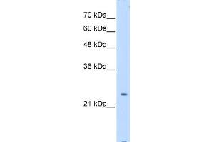WB Suggested Anti-PTPN2 Antibody Titration:  0. (PTPN2 antibody  (Middle Region))