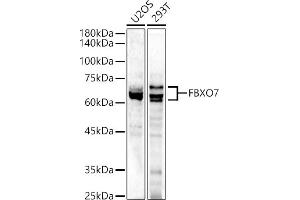 Western blot analysis of extracts of various cell lines, using FBXO7 antibody (ABIN6130383, ABIN6140527, ABIN6140528 and ABIN6223349) at 1:500 dilution. (FBXO7 antibody  (AA 353-522))