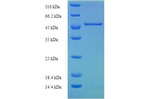 SLC25A30 Protein (AA 1-291, full length) (His-SUMO Tag)