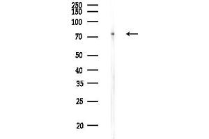 anti-ATP-Binding Cassette, Sub-Family B (MDR/TAP), Member 10 (ABCB10) (Internal Region) antibody