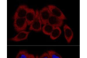 Confocal immunofluorescence analysis of HeLa cells using RPL23 Polyclonal Antibody at dilution of 1:200. (RPL23 antibody)