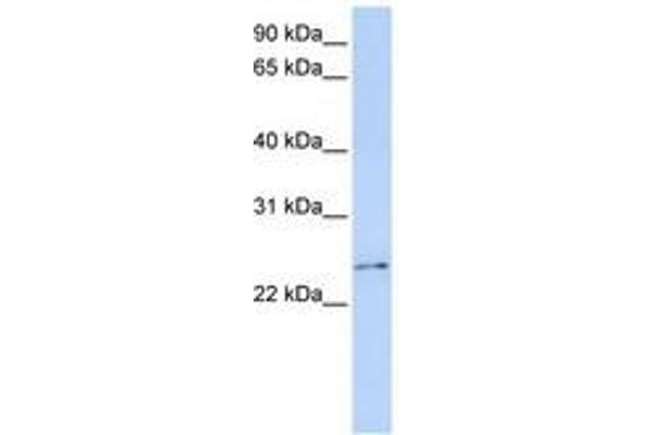 RCAN3 antibody  (C-Term)