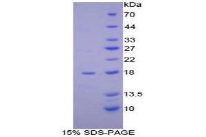 SDS-PAGE (SDS) image for alpha Hemoglobin Stabilizing Protein (aHSP) (AA 1-102) protein (His tag) (ABIN1098839) (aHSP Protein (AA 1-102) (His tag))