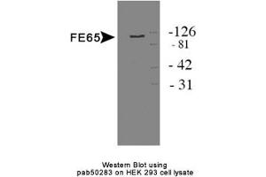 Image no. 1 for anti-Amyloid beta (A4) Precursor Protein-Binding, Family B, Member 1 (Fe65) (APBB1) antibody (ABIN363592) (FE65 antibody)