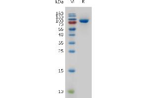 SDS-PAGE (SDS) image for Transferrin Receptor (p90, CD71) (TFRC) (AA 89-760) protein (His tag) (ABIN7491075)