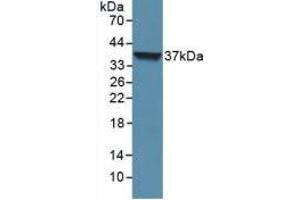Western blot analysis of recombinant Human LOR. (LOR antibody  (AA 210-295))