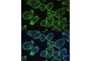 Immunofluorescence analysis of human placenta using Cytokeratin 13 (Cytokeratin 13 (KRT13)) Polyclonal Antibody (ABIN7268090) at dilution of 1:100 (40x lens). (Cytokeratin 13 antibody  (AA 269-458))
