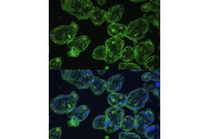 Immunofluorescence analysis of human placenta using Cytokeratin 13 (Cytokeratin 13 (KRT13)) Polyclonal Antibody (ABIN7268090) at dilution of 1:100 (40x lens). (Cytokeratin 13 antibody  (AA 269-458))