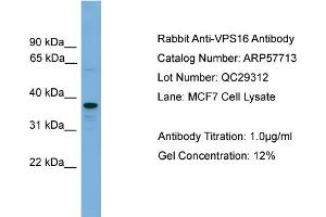 WB Suggested Anti-VPS16  Antibody Titration: 0. (VPS16 antibody  (N-Term))
