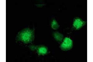 Immunofluorescence (IF) image for anti-Microtubule-Associated Protein, RP/EB Family, Member 2 (MAPRE2) antibody (ABIN1499317)